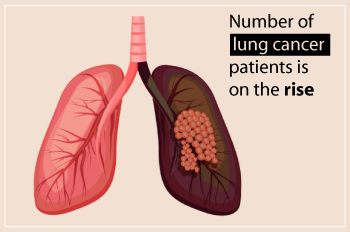 দেশে ফুসফুসের ক্যান্সারের রোগীর ব্যাপক সংখ্যা বৃদ্ধি