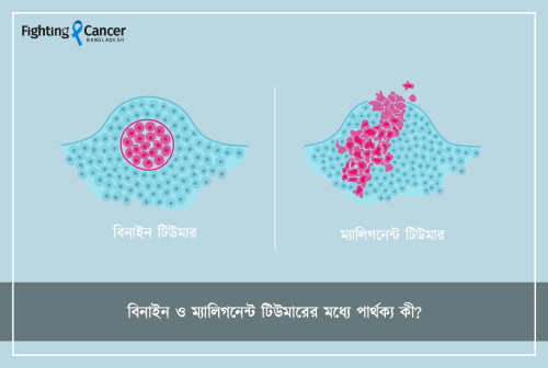 বিনাইন ও ম্যালিগনেন্ট টিউমারের মধ্যে পার্থক্য কী?